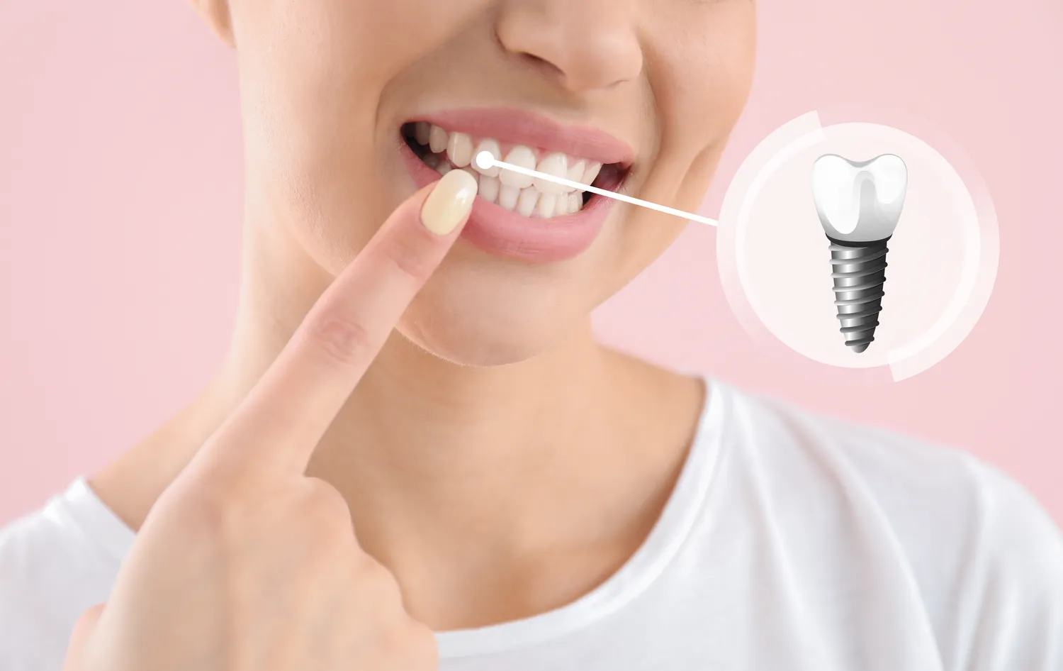 Zabiegi dentystyczne refundowane przez NFZ