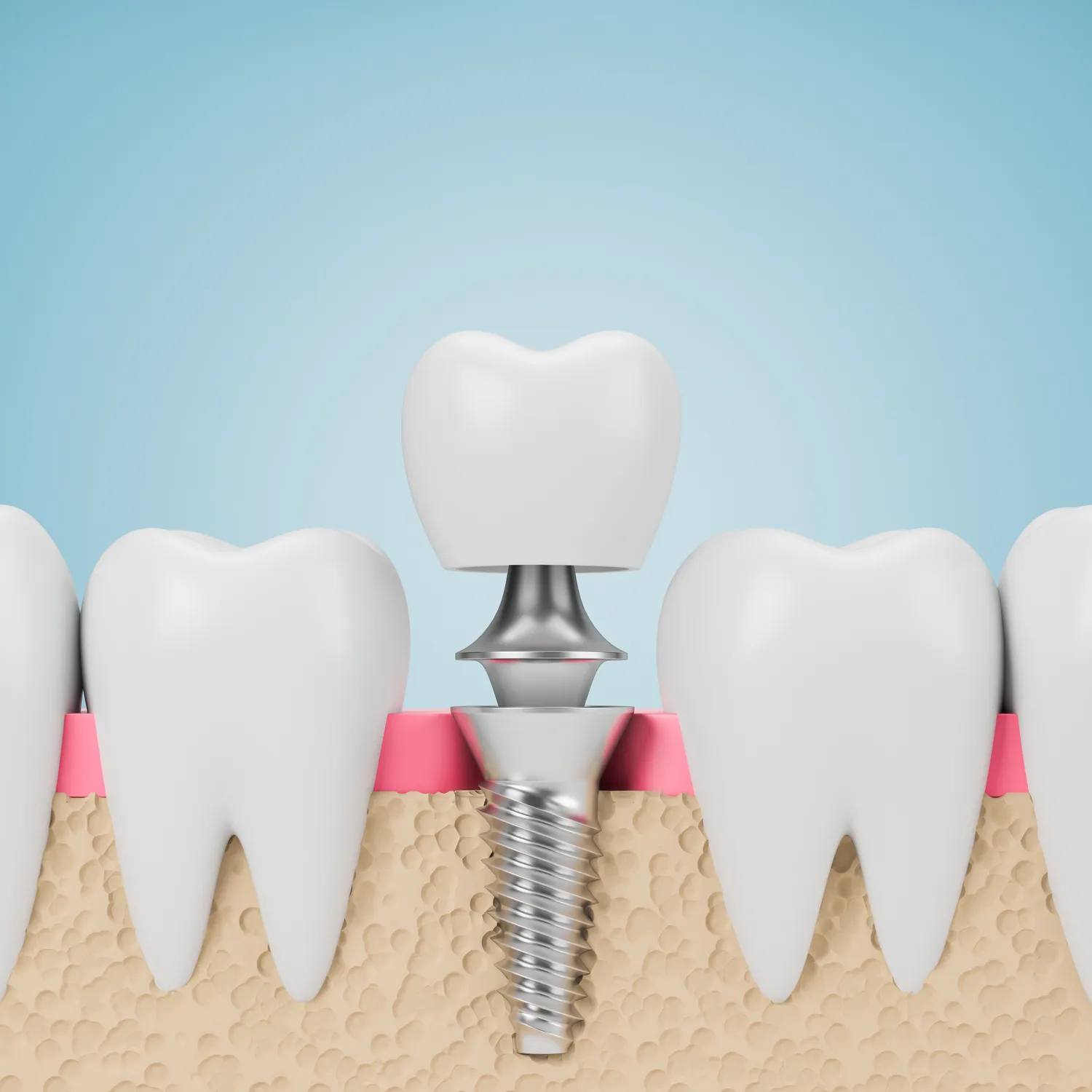 Wybór dobrego dentysty
