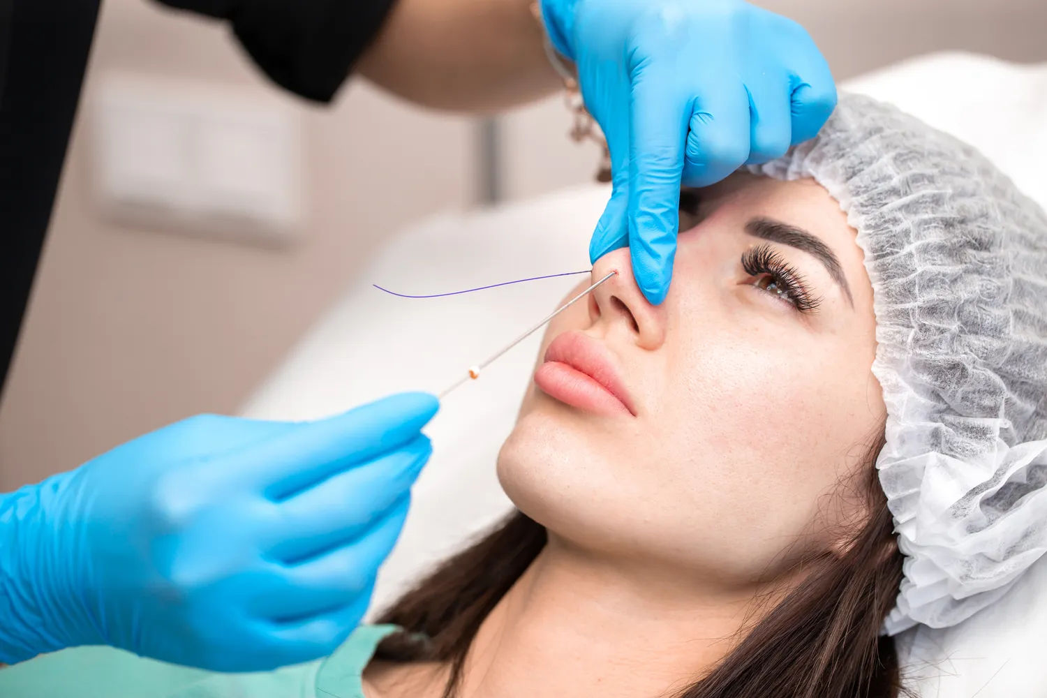 E recepta o co chodzi?