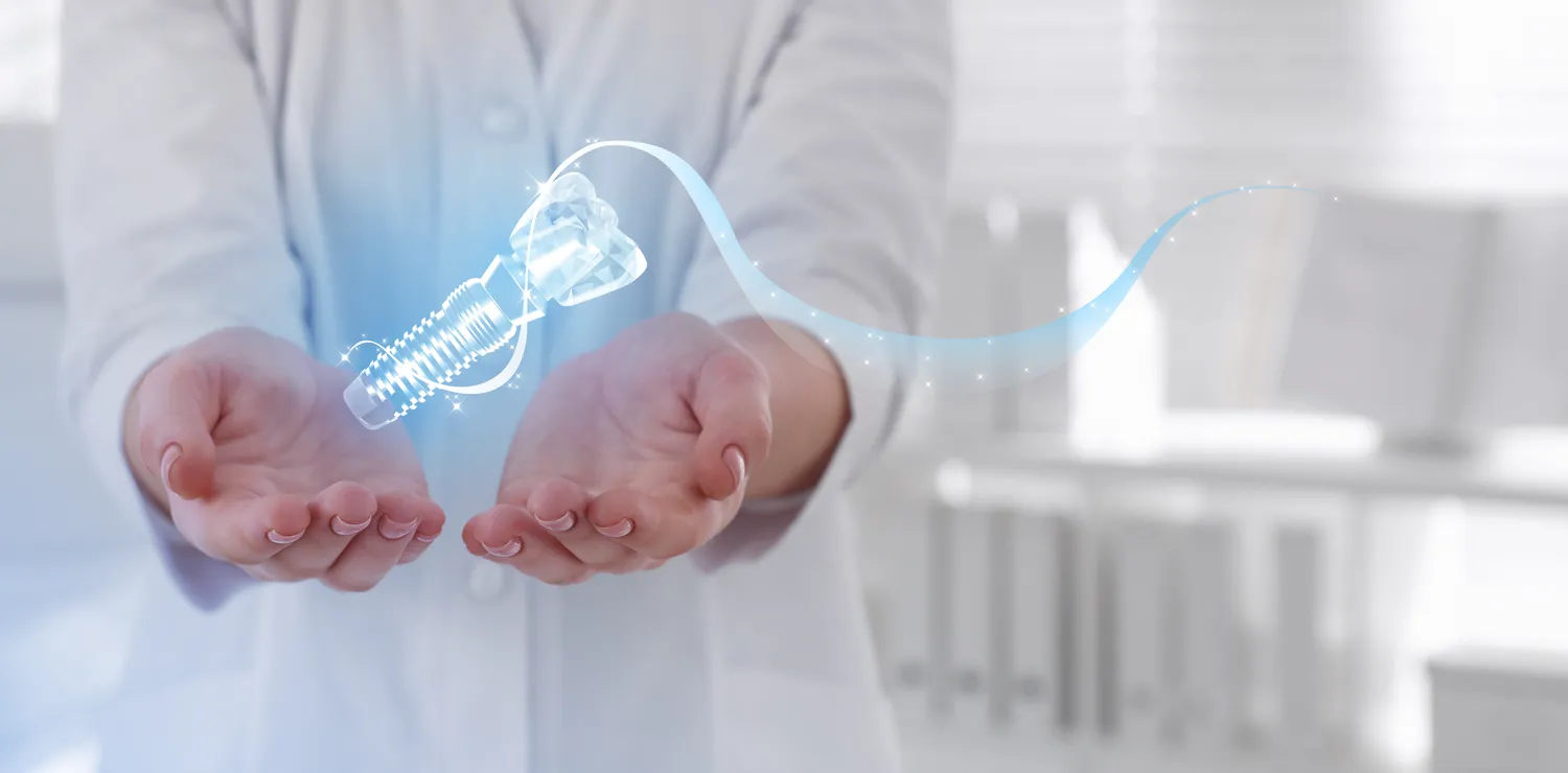 Implanty zębów Szczecin