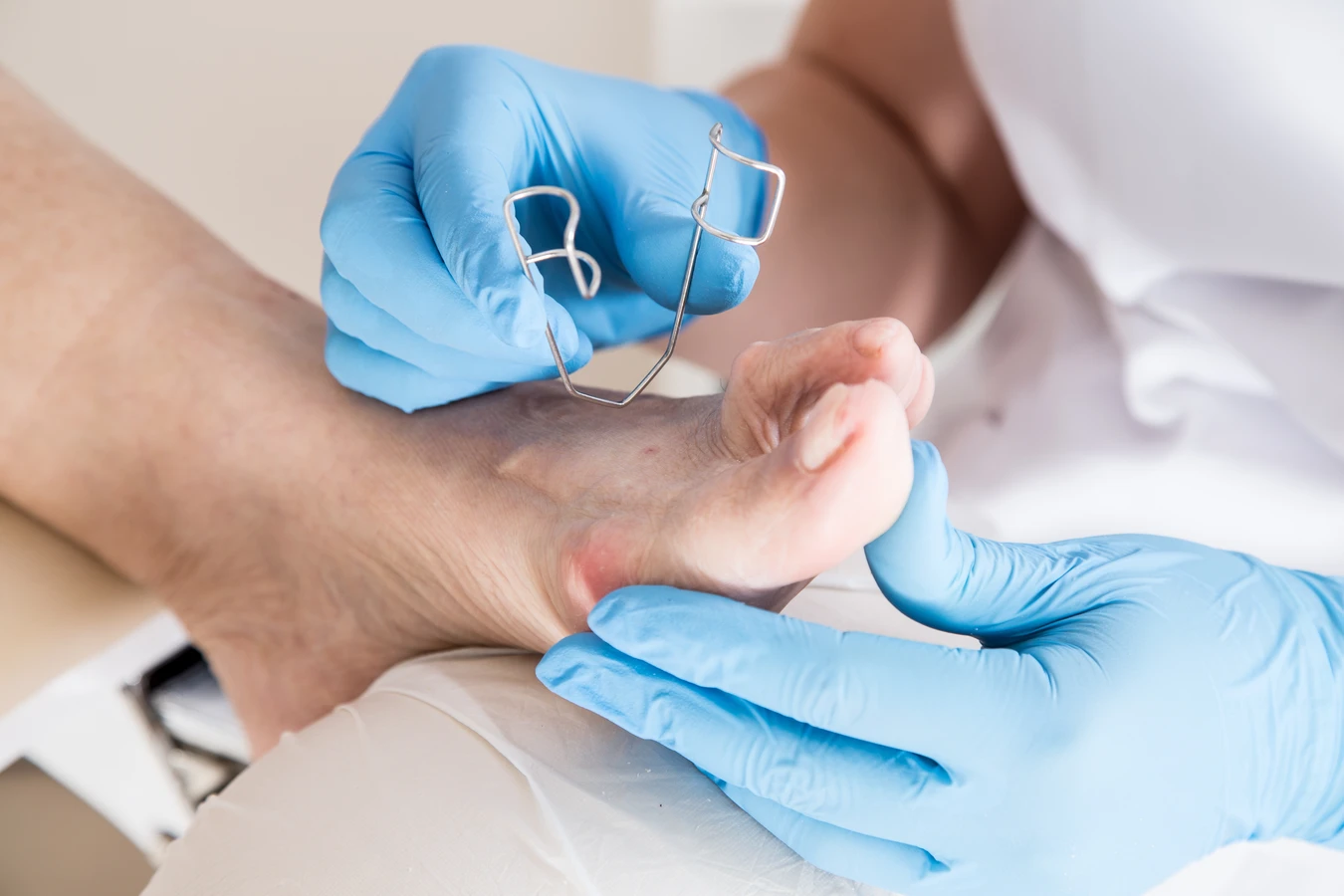 Podologia - czym jest specjalistyczna troska o stopy?