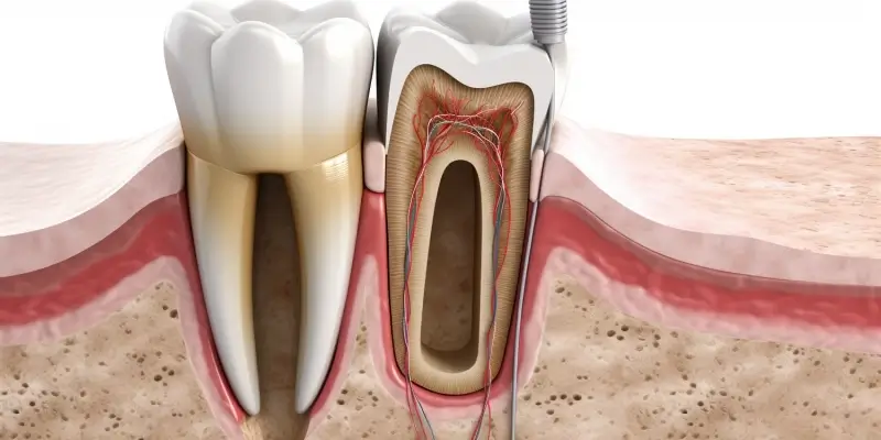 Endodoncja mikroskopowa szczecin